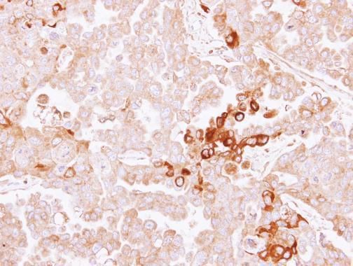 Alpha 2 Antiplasmin Rabbit Polyclonal Antibody