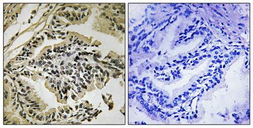 PEK/PERK (Phospho-Thr981) Antibody