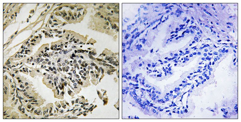 PEK/PERK (Phospho-Thr982) Antibody