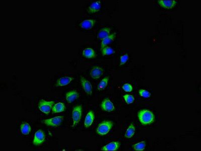 PEMT Antibody