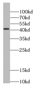 Pepsinogen II antibody