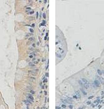 PepT1 Rabbit Polyclonal Antibody