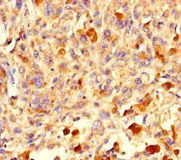 Peptidyl-tRNA hydrolase ICT1, mitochondrial antibody