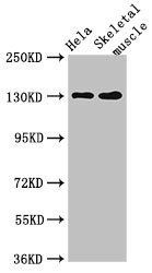 PER3 antibody