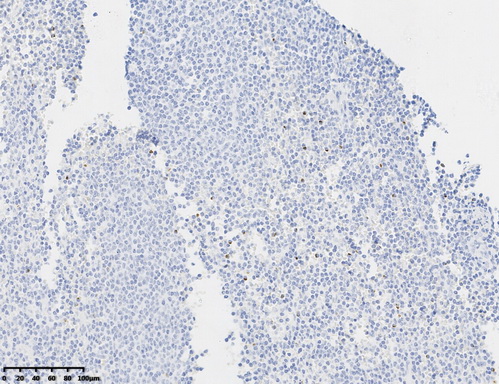 Perforin (PRF1) antibody