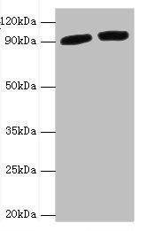 Periostin antibody