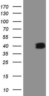 Periostin (POSTN) antibody