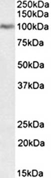 Periostin antibody