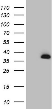 Peripherin (PRPH) antibody