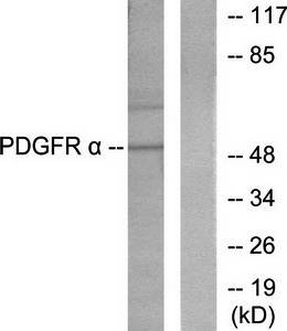 Peripherin antibody