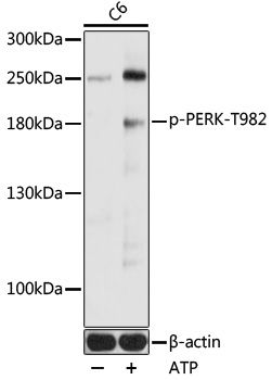 PERK (Phospho-T982) antibody