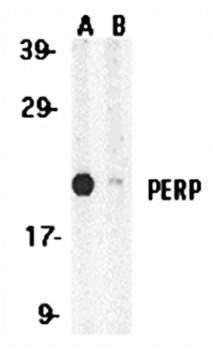 PERP Antibody