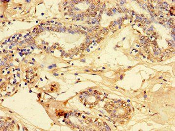 PET100 Antibody