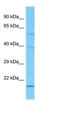 PET112 antibody