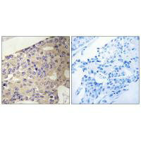 PEX10 Antibody
