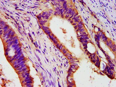 PEX26 Antibody