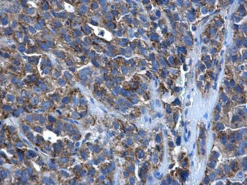 PEX26 Rabbit Polyclonal Antibody