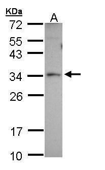 PEX26 Rabbit Polyclonal Antibody