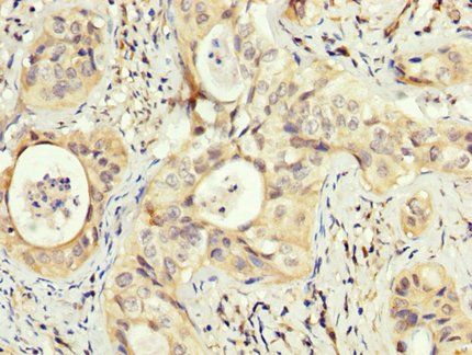 PEX5 Antibody