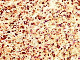 PF4 Antibody