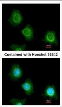 PF4V1 antibody