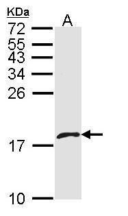 PF4V1 Rabbit Polyclonal Antibody