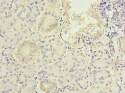 PFDN2 Antibody