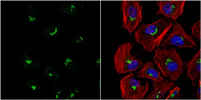 VHL binding protein 1 Antibody