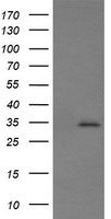 PFDN3 Antibody