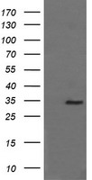 PFDN3 Antibody