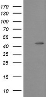 PFDN3 (VBP1) antibody