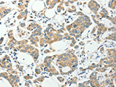 PFDN6 Antibody