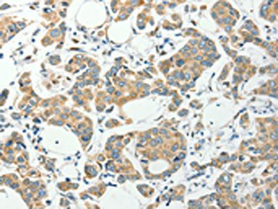 PFDN6 antibody