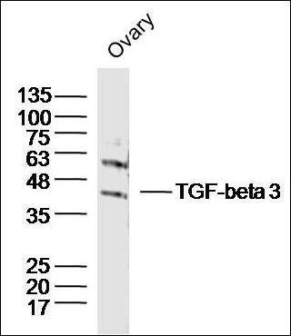 PFK1 antibody