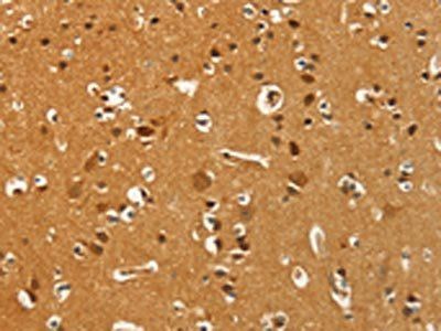 PFKFB1 Antibody