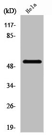 PFKFB1/PFKFB4 Antibody