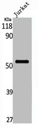 PFKFB1 antibody