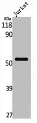 PFKFB1 Antibody
