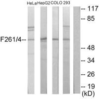 PFKFB1/PFKFB4 Antibody