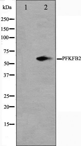 PFKFB2 antibody