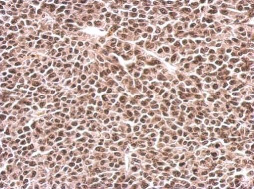 PFKFB3 antibody [C3], C-term