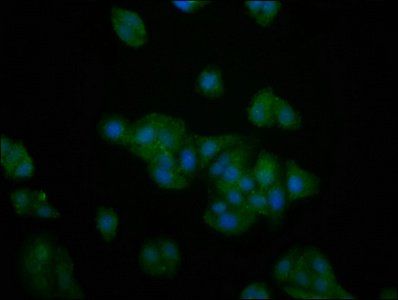 PFKFB4 antibody