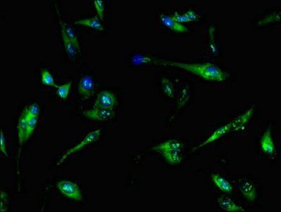 PFKL Antibody