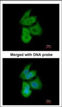 PFKL antibody [C1C3]