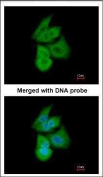 PFKL antibody