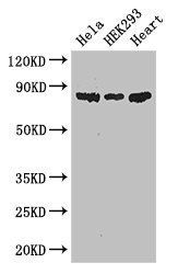 PFKM Antibody