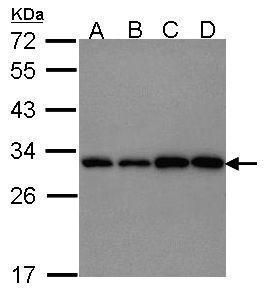 PGAM1 Rabbit Polyclonal Antibody