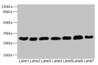 PGAM2 antibody