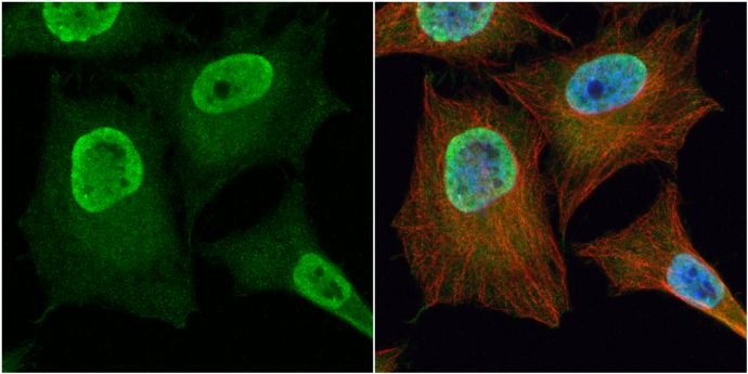 phosphoglycerate mutase 2 Antibody