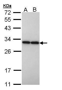 PGAM2 Rabbit Polyclonal Antibody